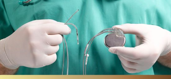 Marca-passo no Gama - Life Centro Cardiológico